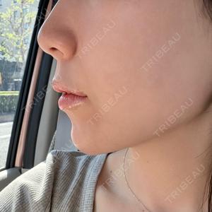 ルラ美容クリニック 京都院口コミ