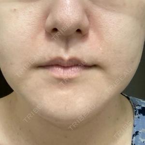 HAAB×DREAM BEAUTY CLINIC 大阪梅田院口コミ