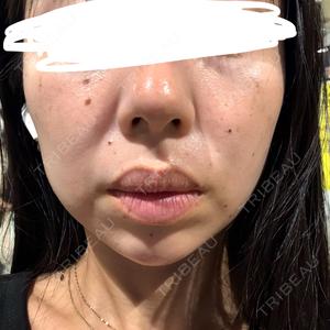 DMTC CLINIC 日本橋院口コミ