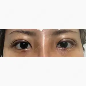 クリスタル美容外科 山形院口コミ