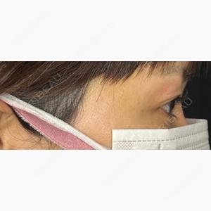ルラ美容クリニック 新宿院口コミ