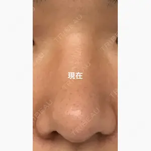 新垣形成外科口コミ