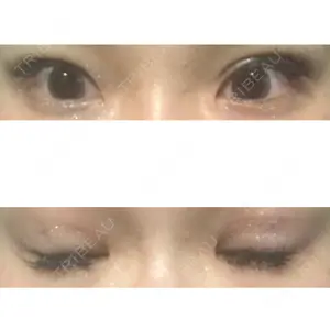 ピュア形成外科医院口コミ