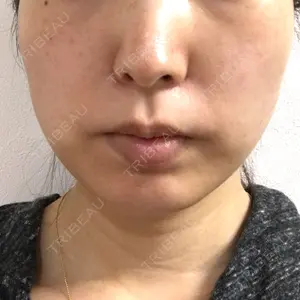 ビクアスクリニック口コミ