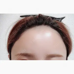 iSTAR美容外科・皮膚科口コミ
