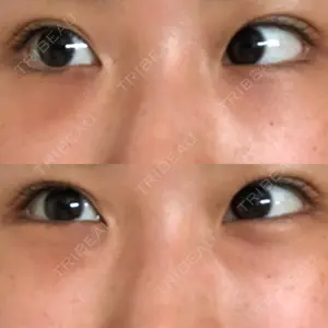 韓国ST美容整形外科口コミ