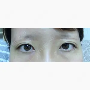 MIYAフェイスクリニック口コミ