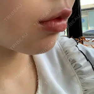 リエンジャン整形外科 弘大店口コミ