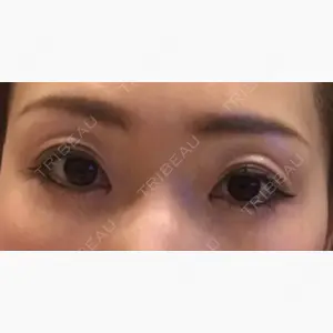 千里中央ゆみスキンクリニック口コミ