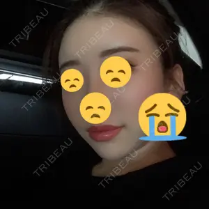 フレッシュ整形外科口コミ