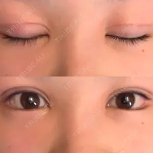 ジュエリー美容外科口コミ