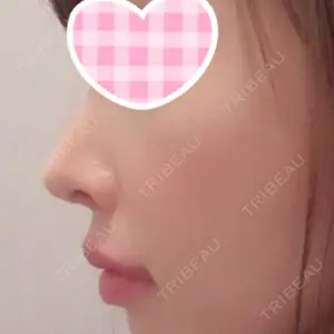 FROM B整形外科 (旧バウム整形外科)口コミ