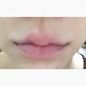 ボナイ整形外科口コミ