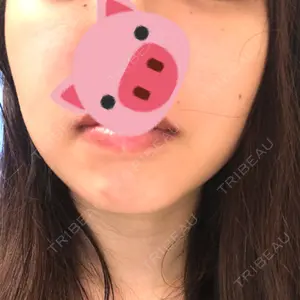 ラコスタ辻堂スキンクリニック口コミ