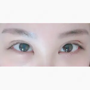 TJ美容外科口コミ
