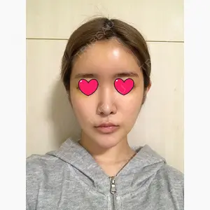 TJ美容外科口コミ