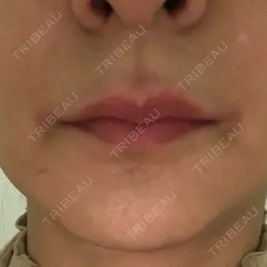 id（アイディ）美容外科口コミ