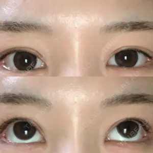 フィラークリニック 新宿院口コミ