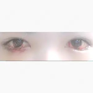 ジュエリー美容外科口コミ