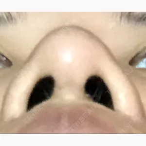 湘南美容クリニック 高松院口コミ