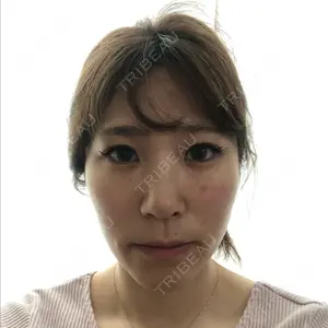 ソウルクイーン整形外科（旧コエンミ整形外科）口コミ