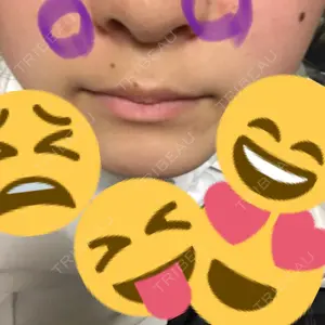 ネクストスキンケアクリニック口コミ