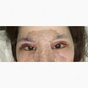 id（アイディ）美容外科口コミ