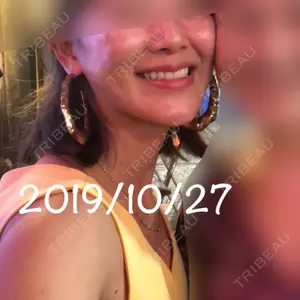 エートップ美容整形外科口コミ