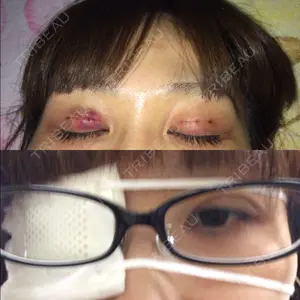 品川美容外科 札幌院口コミ