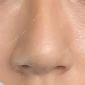 TJ美容外科口コミ