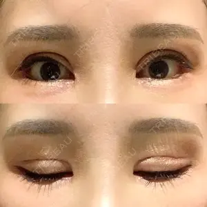 id（アイディ）美容外科口コミ