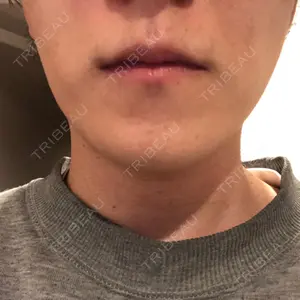 S Beauty Clinic口コミ