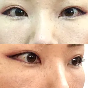 韓国ST美容整形外科口コミ