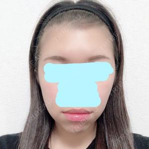 Zetith Beauty Clinic 銀座院口コミ