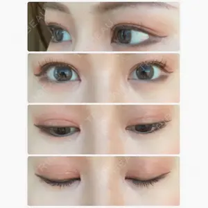 id（アイディ）美容外科口コミ