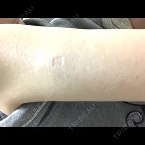 ビクアスクリニック口コミ