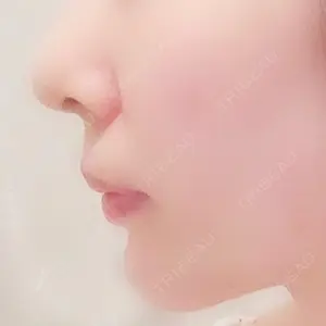 ジュエリー美容外科口コミ