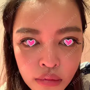 FI整形外科口コミ
