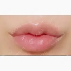 SLIM&YOUNG CLINIC口コミ