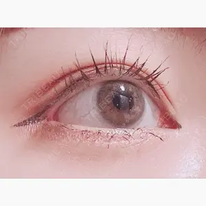 FROM B整形外科 (旧バウム整形外科)口コミ