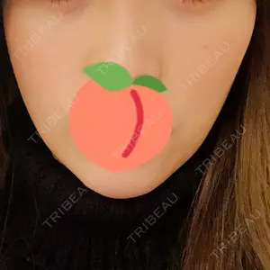 ウィーバー美容外科口コミ