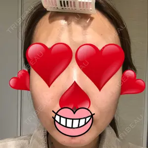 ウィーバー美容外科口コミ