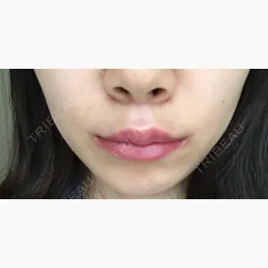 現代美学整形外科口コミ