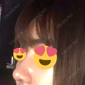 ソウルクイーン整形外科（旧コエンミ整形外科）口コミ