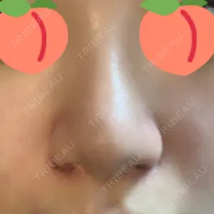 ラボム整形外科口コミ