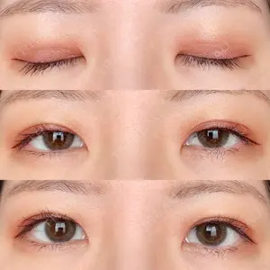 MIYAフェイスクリニック口コミ