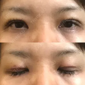 きくな湯田眼科口コミ