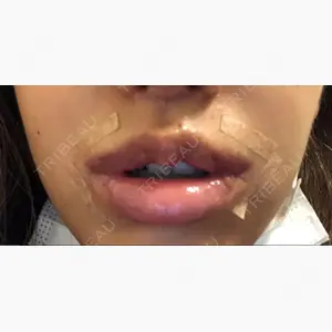 清潭女神美容外科口コミ