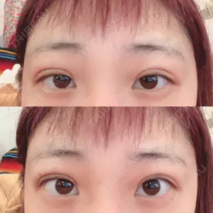 湘南美容クリニック 広島院口コミ