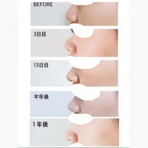 ヒルズ美容クリニック口コミ